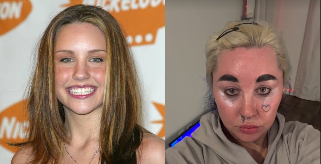 Quién es Amanda Bynes: de estrella de Nickelodeon a un historial de crisis psiquiátricas